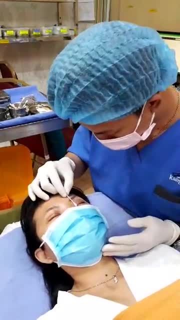 Nếp mí ngay SAU CẮT CHỈ sẽ như nào?