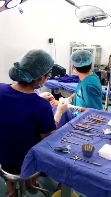Kết quả ca mũi sửa thứ 5 trong ngày cả nhà cùng theo dõi nhé