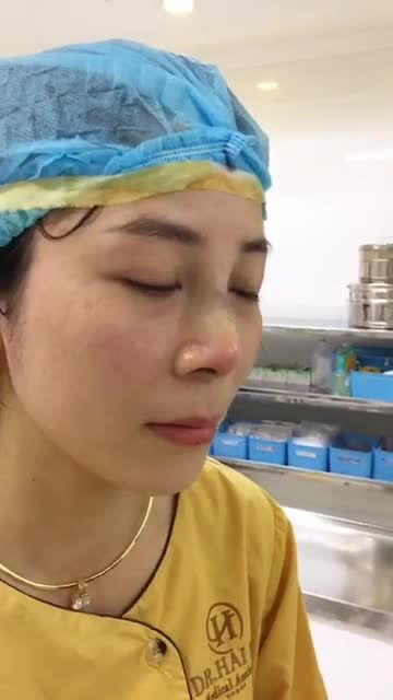 Nâng mũi Demi - 5D , kết quả hoàn hảo vừa thực hiện xong của đội ngũ Bác sĩ tại Dr.Hải Lê