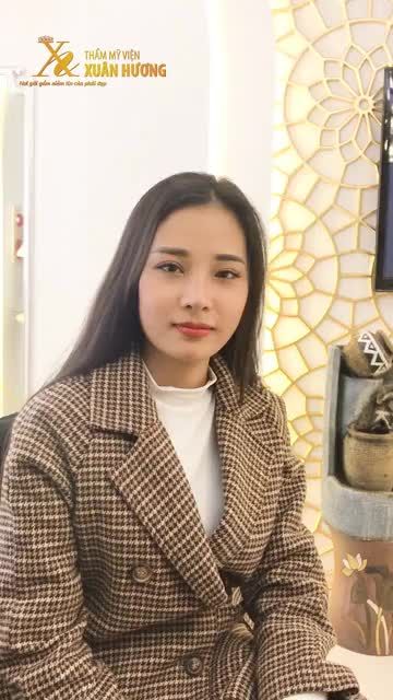 MŨI NÂNG ERGONOMIC ĐẸP TỰ NHIÊN NHƯ CHƯA TỪNG "CHỈNH SỬA" SAU 3 THÁNG