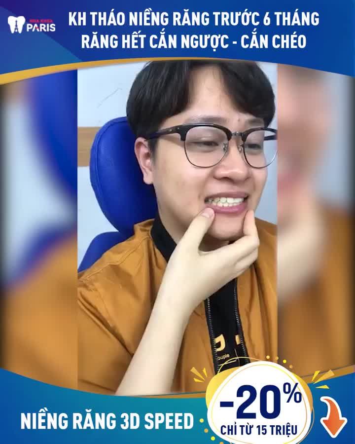 REVIEW CHÂN THỰC CỦA KHÁCH HÀNG THÁO NIỀNG RĂNG TRƯỚC 6 THÁNG