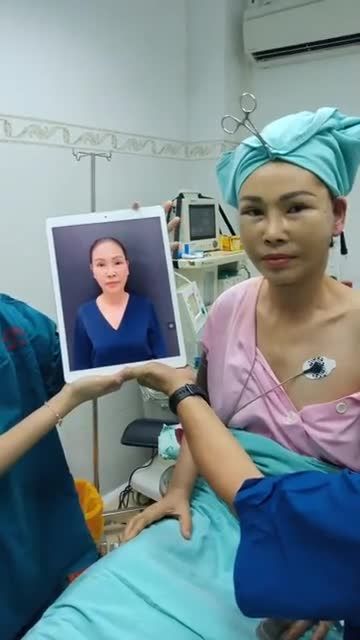 Mẹ ruột của Hoa hậu Phương Linh vừa phẫu thuật Căng da mặt 27 triệu -Căng da cổ 18 triệu xong nè!