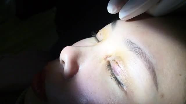 Cận cảnh đôi mắt của bạn gái sau 7 ngày, đẹp ngoài mong đợi