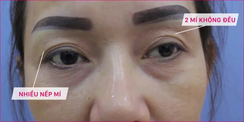 NÂNG CUNG CHÂN MÀY - KÉO THANH XUÂN TRỞ LẠI.