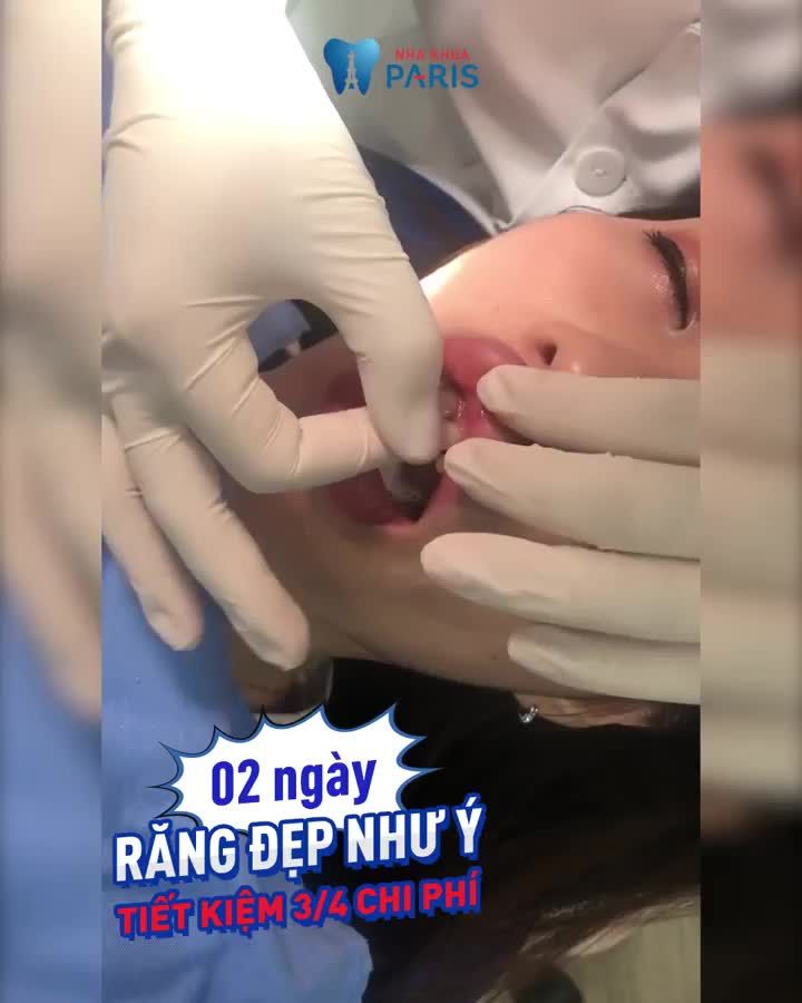 VỀ VIỆT NAM LÀM RĂNG SỨ Ở ĐÂU️