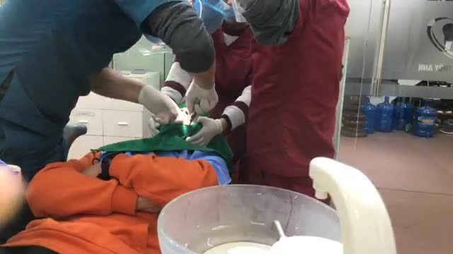 Nhổ cùng lúc 4 răng khôn sẽ như thế nào?