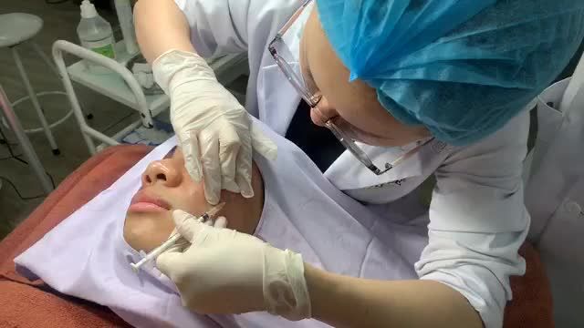 Điều trị sẹo lõm bằng công nghệ Intensif - làm đầy tất cả vết sẹo lõm trên khuôn mặt