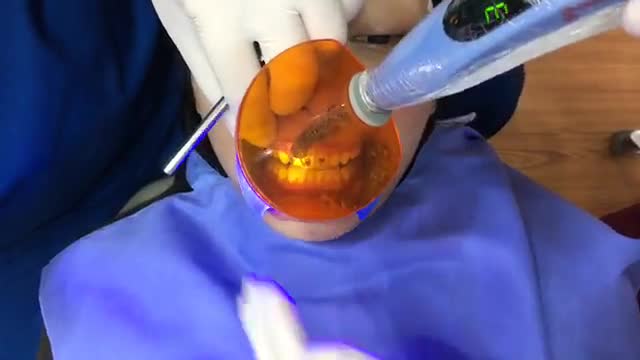 Gắn mắc cài cho bạn Trà My