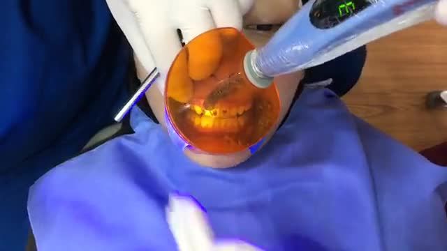 Gắn mắc cài cho bạn Trà My