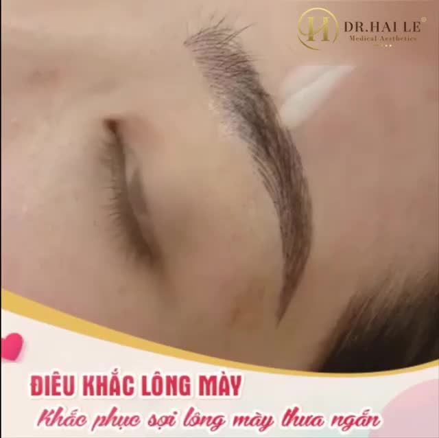 Điêu khắc lông mày SIÊU NÉT, SIÊU CHUẨN - Phun thêu lông mày 3D tại VTM Dr. Hải Lê ‼️