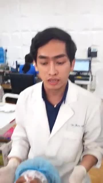 Trị mụn thịt tận gốc với Laser CO2 Fractional tại Kangnam