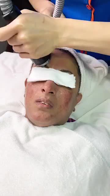 Mục sở thị Khách hàng người Mỹ tới Kangnam làm TRẺ HÓA DA