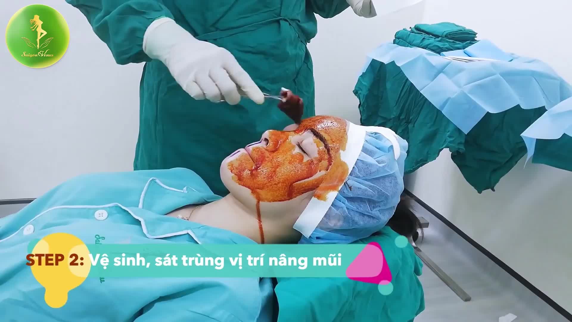CẬN CẢNH TOÀN BỘ  QUÁ TRÌNH NÂNG MŨI SFORM - THƯƠNG HIỆU ĐỘC QUYỀN TẠI SÀI GÒN VENUS