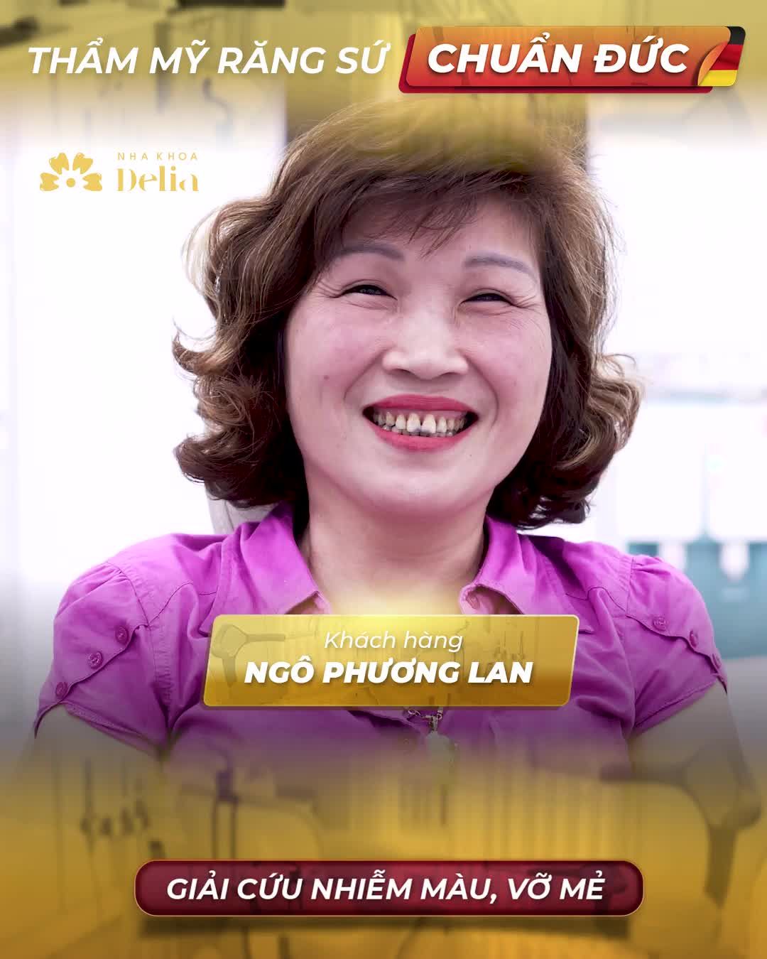 "Giải cứu" ố vàng, nhiễm màu, sâu viền cắn nặng.... Lột xác chỉ sau 2 ngày nhờ Thẩm mỹ răng sứ