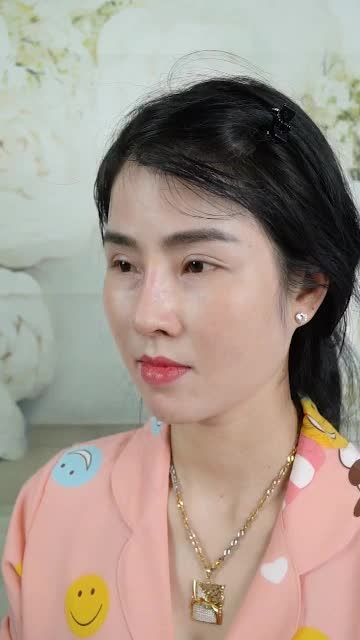 MŨI ĐẸP TỰ NHIÊN SAU 10 NGÀY NÂNG TẠI DR.HOẠT