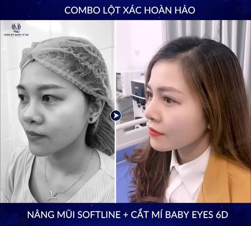 MŨI MÍ NHƯ Ý - TIÊU CHÍ VỮNG BỀN