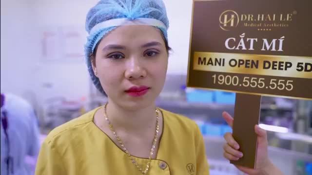 XINH TƯƠI TRẺ HƠN SAU CẮT MÍ MANI OPEN DEEP 5D