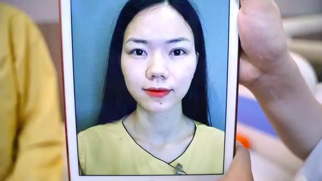 KHẮC PHỤC HOÀN TOÀN những KHUYẾT ĐIỂM của đôi mắt với Công nghệ Cắt mí OPEN DEEP 5D tại Dr.Hải Lê.