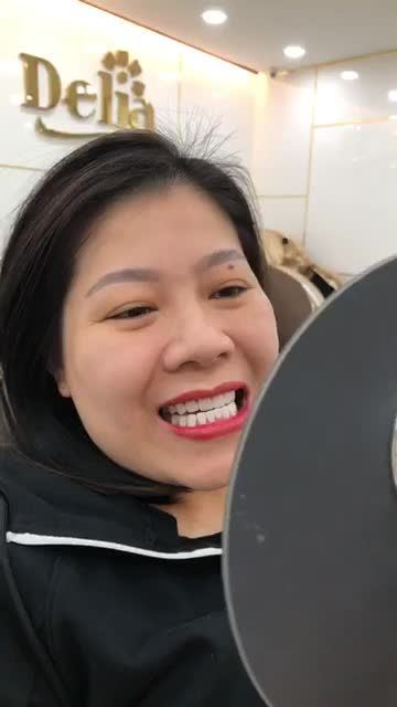 Thẩm mỹ 20 răng sứ Ceramill chuẩn Đức khách hàng tạm biệt tình trạng nhiễm màu, ố vàng, tụt lợ chỉ sau 2 ngày