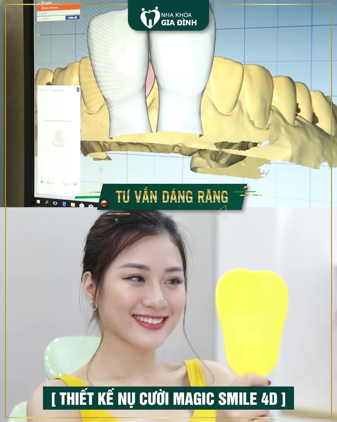 THẨM MỸ RĂNG – BÍ QUYẾT SỞ HỮU NỤ CƯỜI ĐẸP VẠN NGƯỜI MÊ