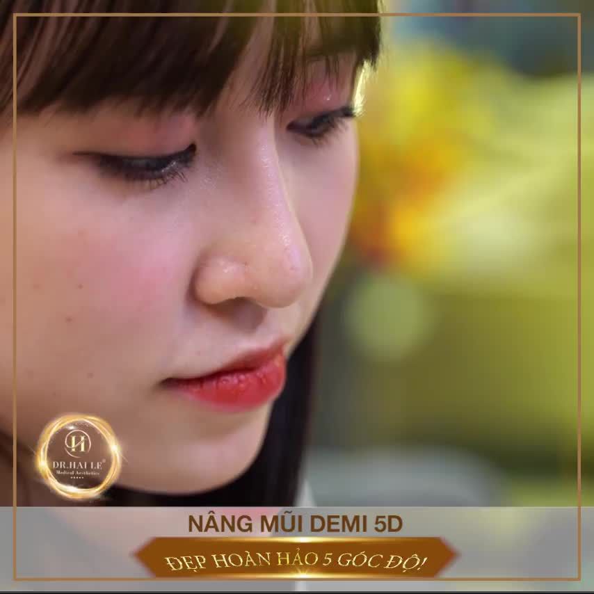5 LÝ DO NÊN CHỌN NÂNG MŨI DEMI 5D tại DR.HẢI LÊ‼️