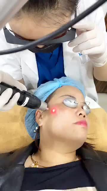 TÀN NHANG BẨM SINH lốm đốm trên mặt, thổi bay với Laser Picosure