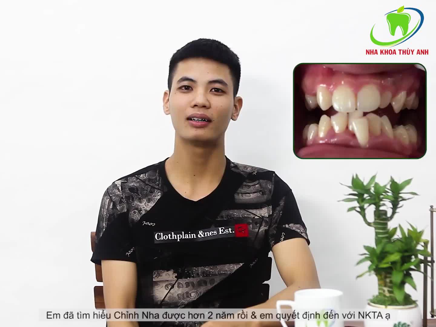 NIỀNG RĂNG GẶP PHẢI NHỮNG KHÓ KHĂN GÌ?