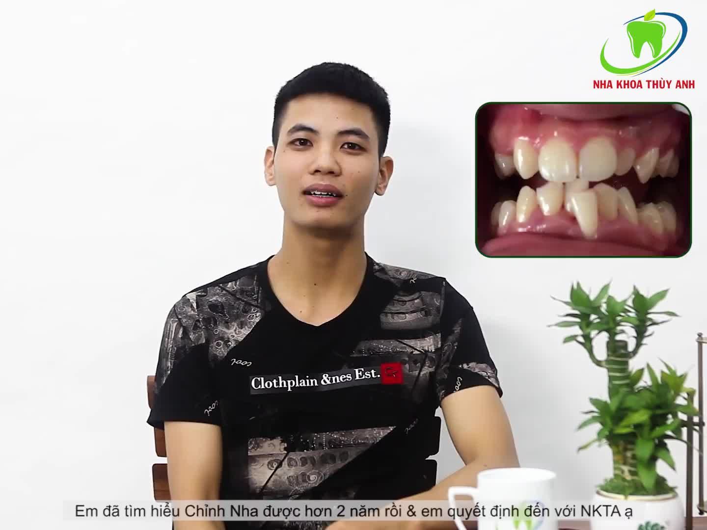 NIỀNG RĂNG GẶP PHẢI NHỮNG KHÓ KHĂN GÌ?