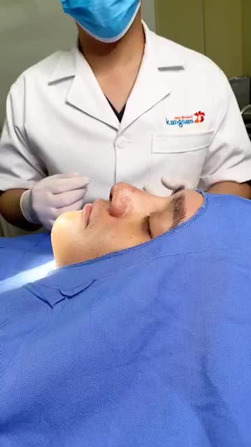 SAU 10 NGÀY Mũi S-line lên dáng cực MÊ