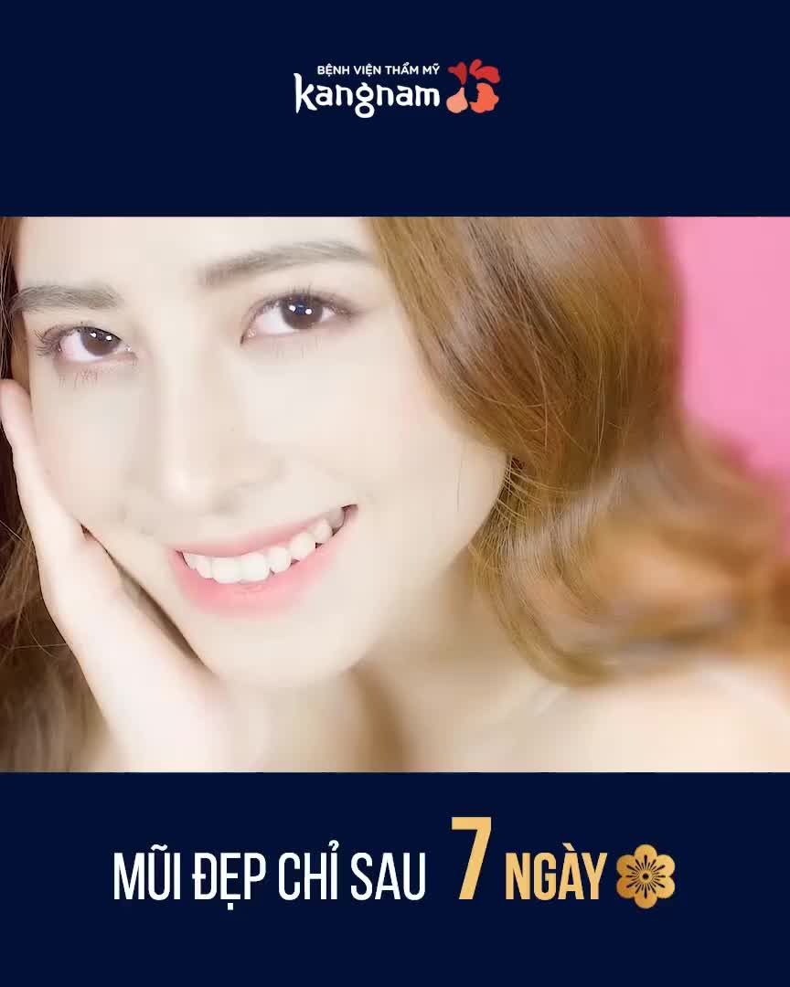 NÂNG MŨI CẤU TRÚC 4D - Công nghệ nâng mũi 2020
