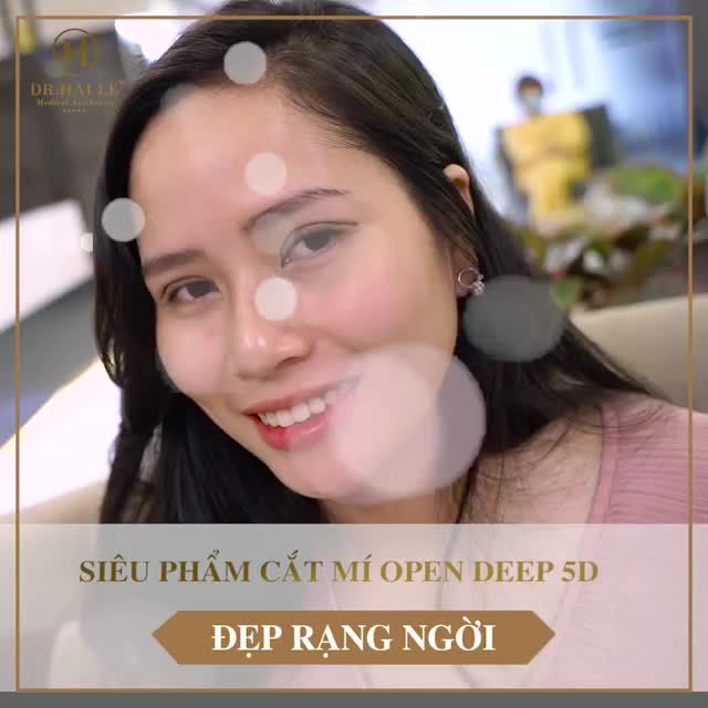 CẮT MÍ TẠI DR. HẢI LÊ - ƯU ĐÃI ĐẾN 50% +++BẬT MÍ 3 LÍ DO LỰA CHỌN CẮT MÍ TẠI VTM DR.HẢI LÊ.