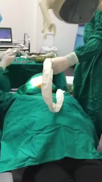 Ca cấy ghép 4 răng Implant cho khách hàng Nguyễn Thị Hương tại Shinbi Dental