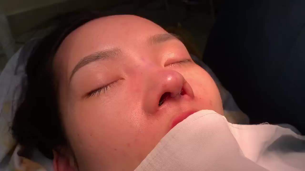 Không ai khách ngoài BS Khanh có thể làm được điều đó để cô khách có thể yên tâm về nhà từ từ chờ mũi lành sau 6 tháng.