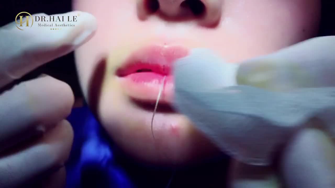 TIÊM MÔI BABY Nhìn thôi đủ hút mọi ánh nhìn