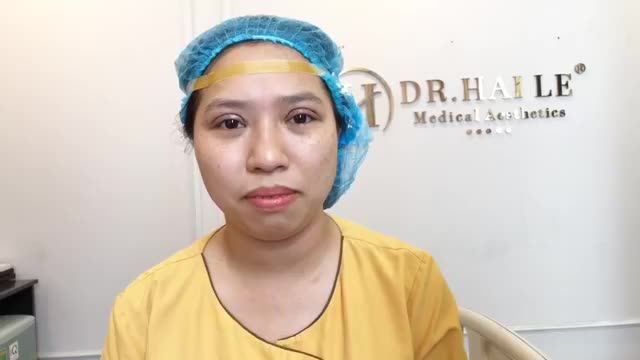 KẾT QUẢ CẮT MÍ MANI OPEN DEEP 5D TẠI DR.HẢI LÊ