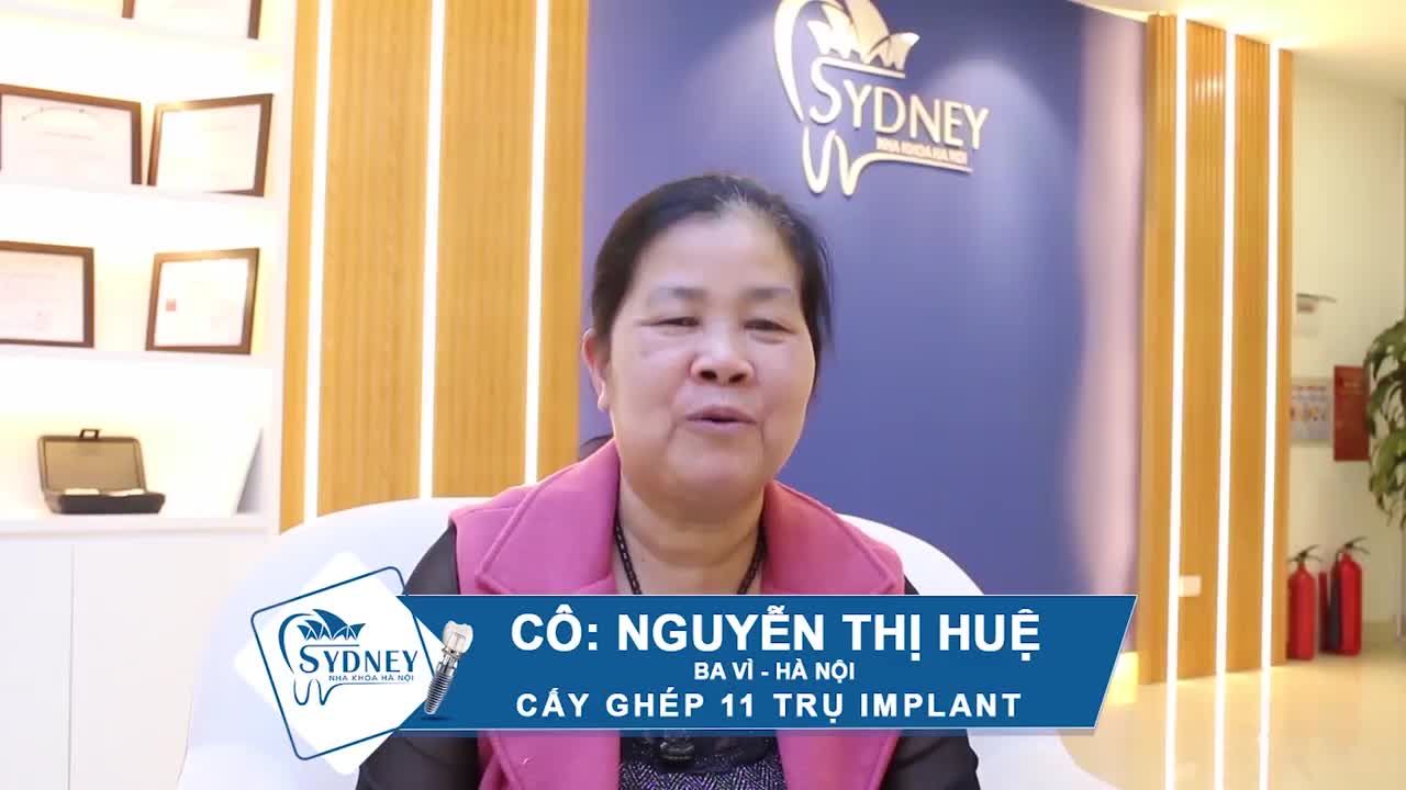 KHÁCH CẤY 11 TRỤ IMPLANT CHIA SẺ ?