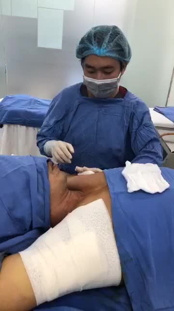 Quy trình băng ép hút tuyến mồ hôi nách bước quan trọng với dịch vụ CHỮA HÔI NÁCH ENDO DRY tại KangNam