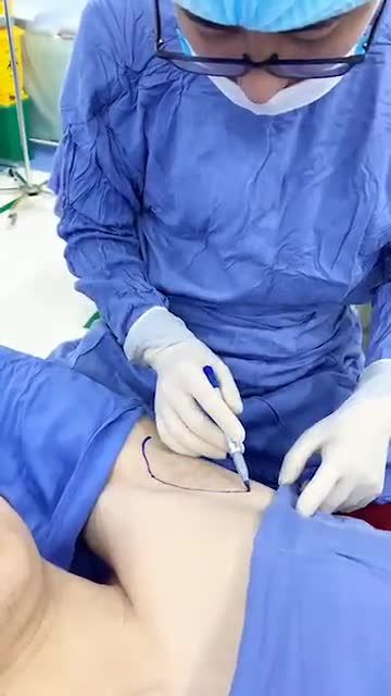 QUÁ TRÌNH CHIẾU SÁNG CỦA CÔNG NGHỆ ENDO DRY - Hút tuyến mồ hô, loại bỏ 90% mùi hôi nách