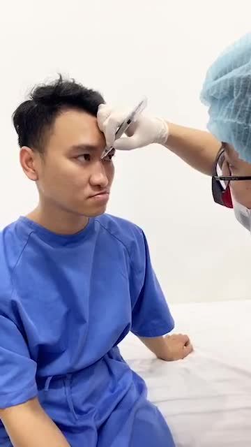Bác sĩ kangnam phân tích ca nâng mũi sụn sườn phức tạp