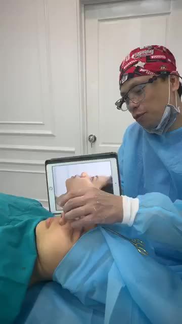 Kết quả nâng mũi siêu cấu trúc Surgiform (tiếp tục)