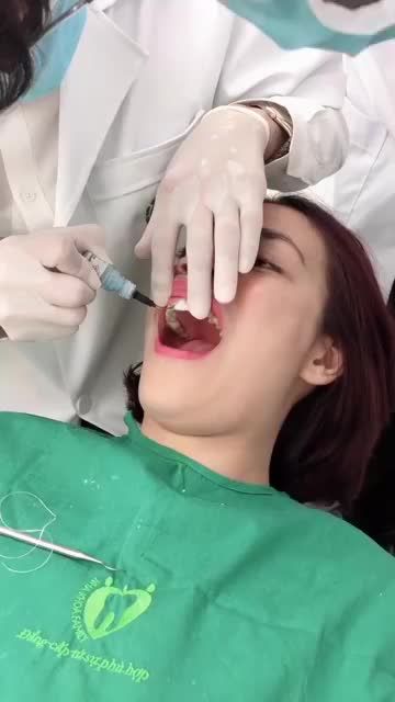 CẬN CẢNH QUY TRÌNH DÁN SỨ VÔ KHUẨN