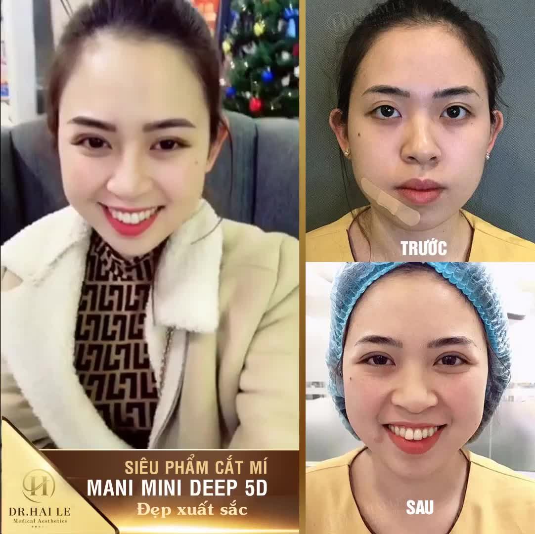 ĐẸP XUẤT THẦN SAU 30 PHÚT CẮT MÍ MANI MINI DEEP 5D