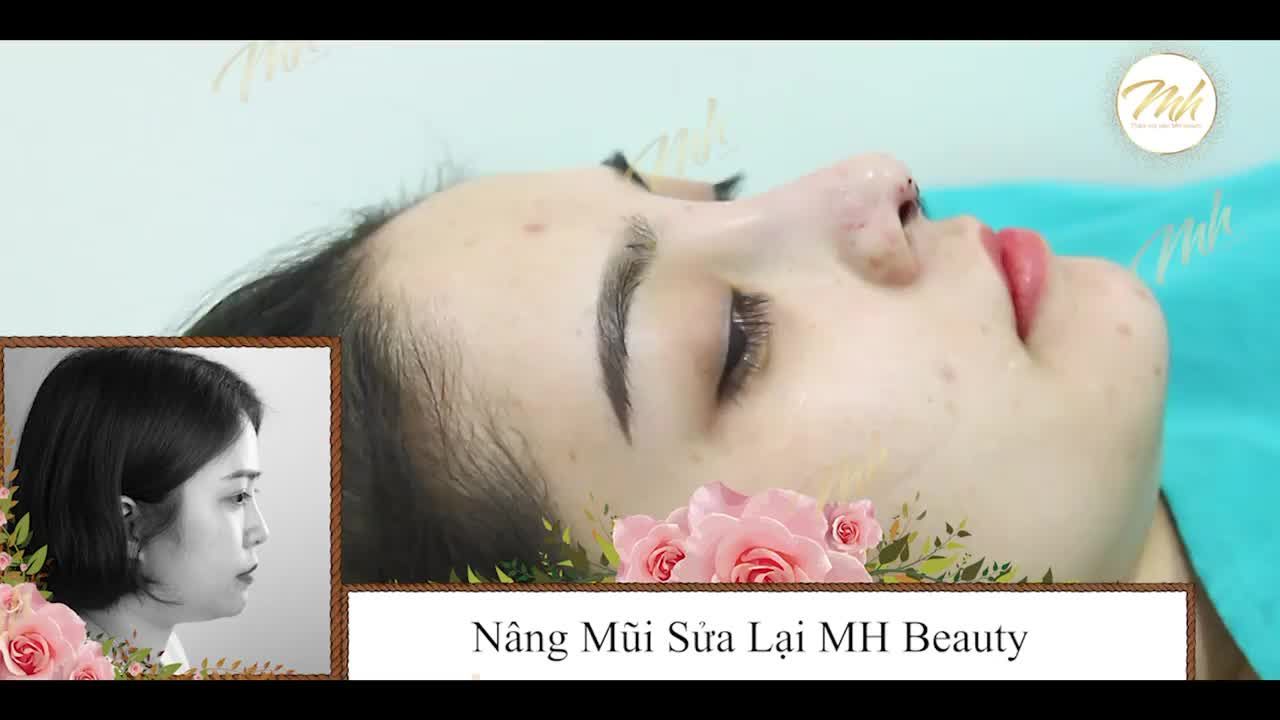 ĐÃ XINH ĐÂU CẦN PHẢI VỘI