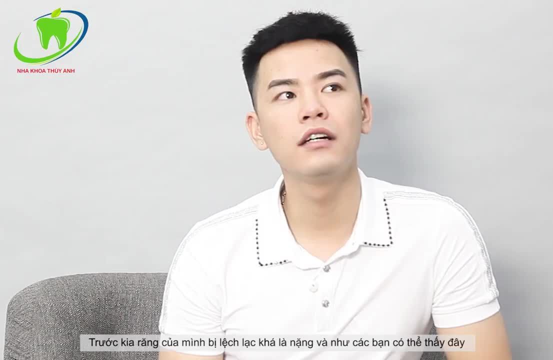 RĂNG LỆCH LẠC, KHẤP KHỂNH CỨ ĐỂ NIỀNG RĂNG CÂN HẾT