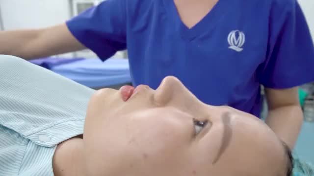 Kết quả ca nâng mũi softline đầu tiên trong buổi sáng ngày hôm nay ! Đăng ký ngay hôm nay, nâng mũi Softline chỉ từ 8,6 triệu !