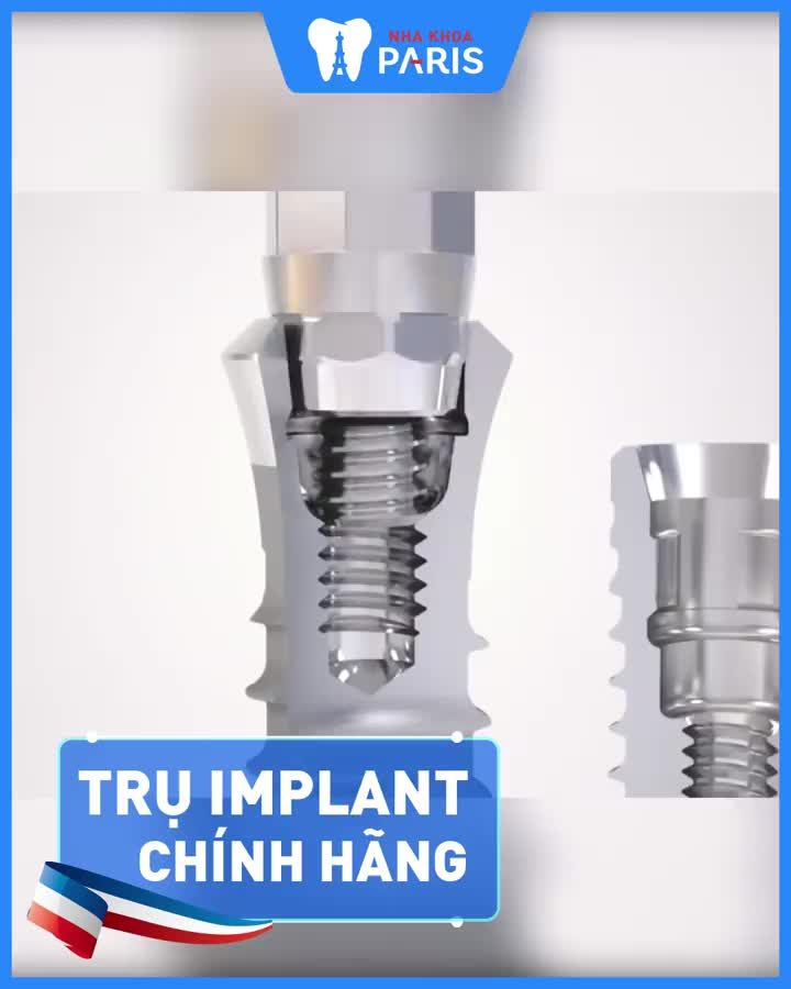 TRỒNG RĂNG IMPANT HẾT MẤT RĂNG - TỰ TIN ĂN NHAI