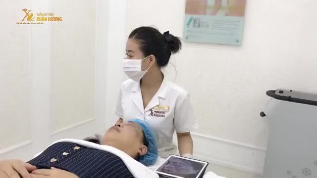 BỚT SẮC TỐ OTA BẨM SINH ĐEN KÍN NỬA MẶT CŨNG PHẢI "ĐẦU HÀNG" TRƯỚC MELAS PICOSURE