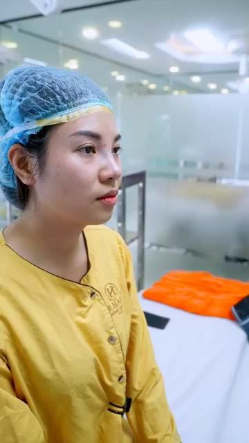 Chinh phục cả góc nghiêng lẫn góc chính diện với kết quả thẩm mỹ nâng mũi tại Dr.Hải Lê!