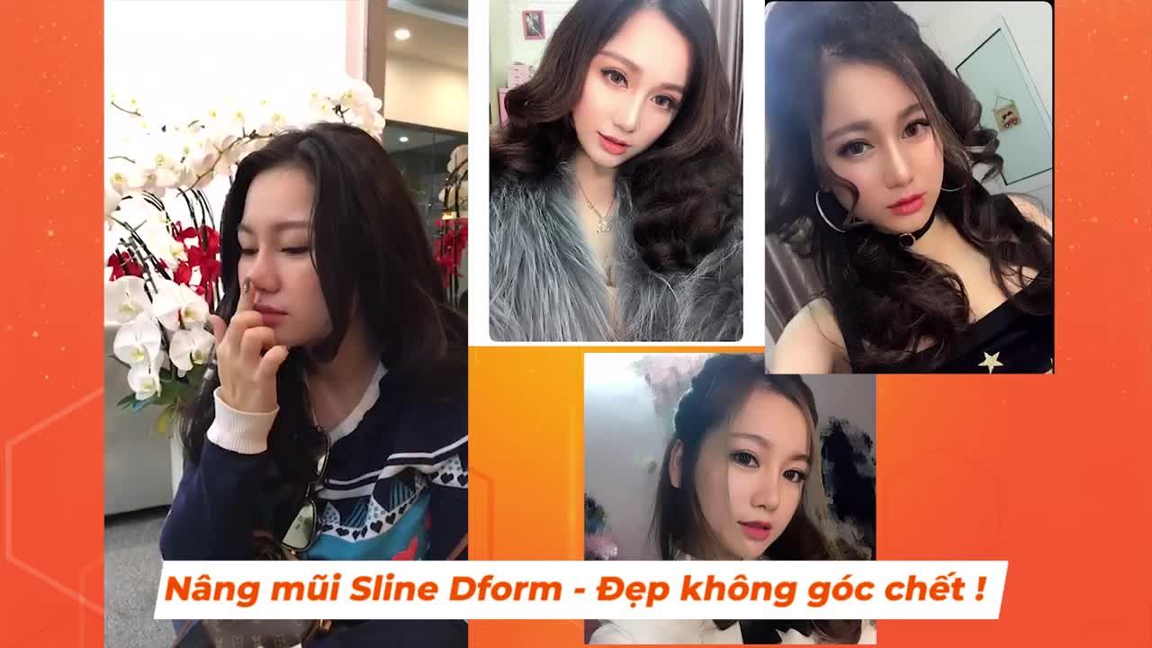 Nâng mũi Sline Dform - Đẹp mọi góc nhìn