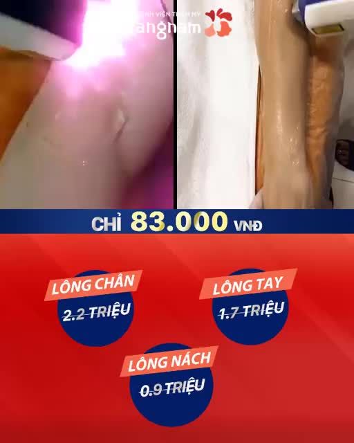 TRIỆT LÔNG VĨNH VIỄN - GIÁ RẺ NHƯ CHO - 83K cho buổi đầu